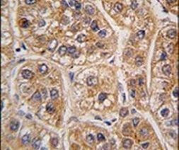 AKR1A1 Antibody in Immunohistochemistry (IHC)