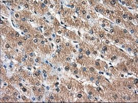 AKR1A1 Antibody in Immunohistochemistry (Paraffin) (IHC (P))