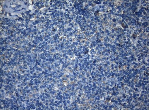 AKT1 Antibody in Immunohistochemistry (Paraffin) (IHC (P))