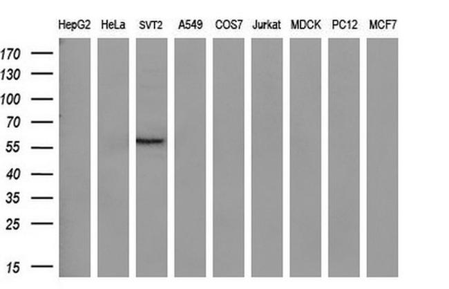 AKT2 Antibody in Western Blot (WB)