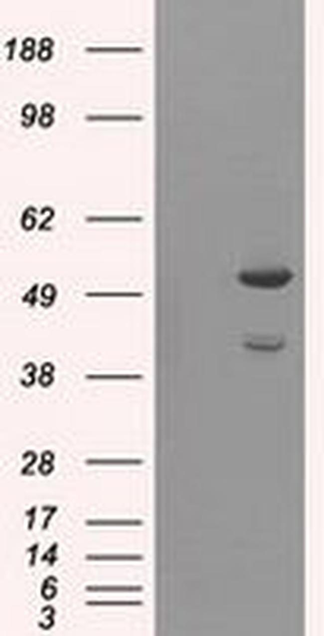AKT2 Antibody in Western Blot (WB)