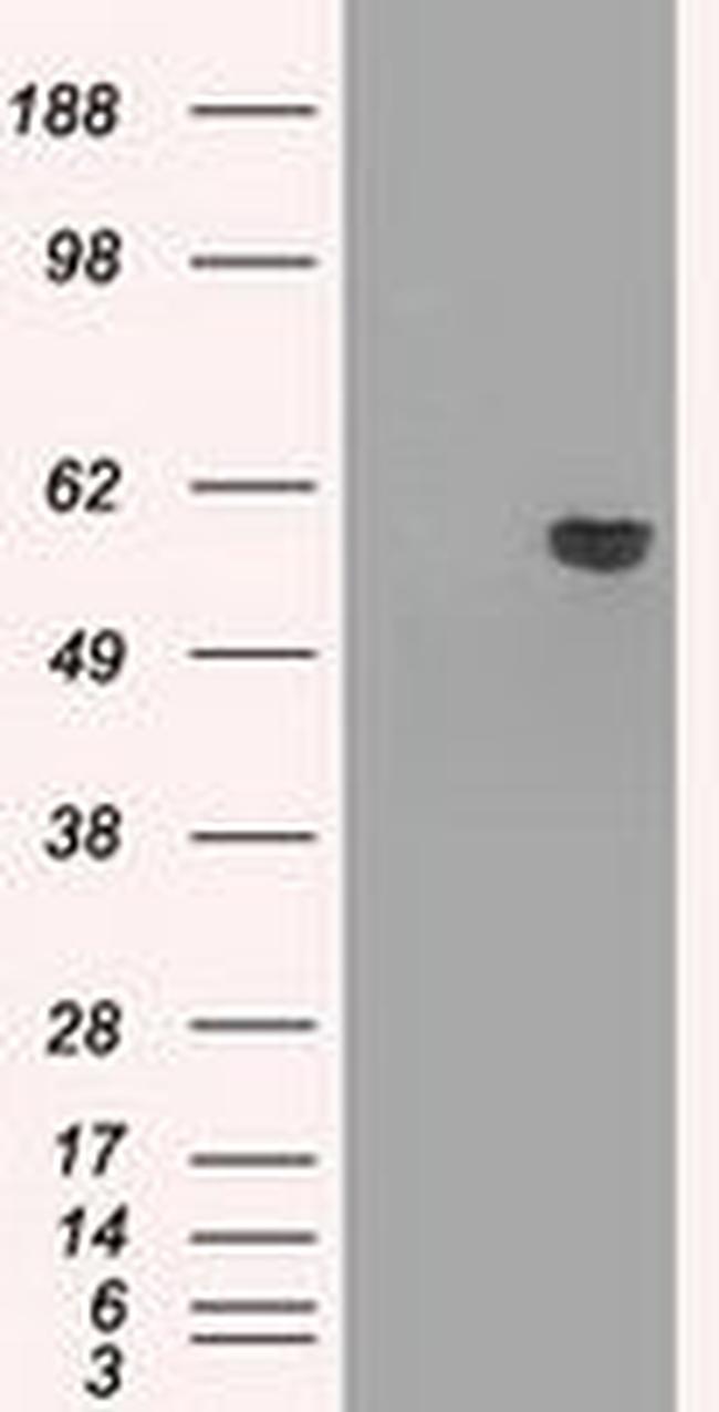 AKT2 Antibody in Western Blot (WB)