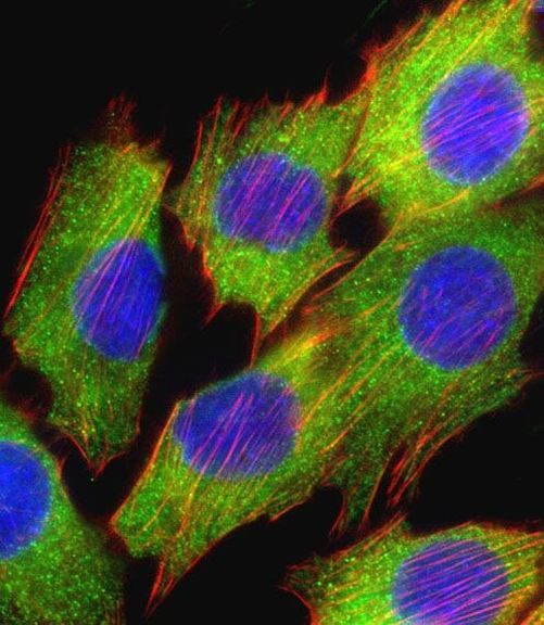 AKT2 Antibody in Immunocytochemistry (ICC/IF)