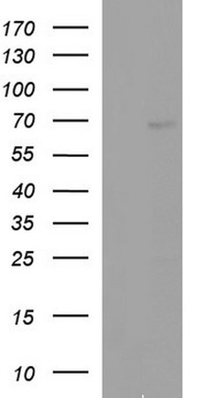 ALB Antibody in Western Blot (WB)