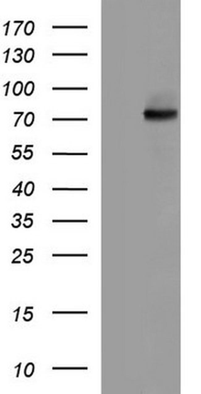 ALB Antibody in Western Blot (WB)