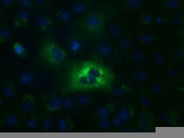 ALDH1L1 Antibody in Immunocytochemistry (ICC/IF)