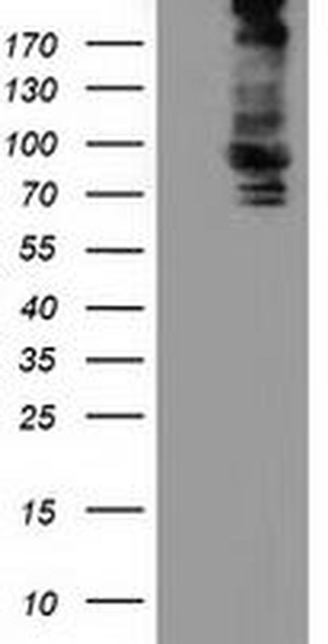 ALDH1L1 Antibody in Western Blot (WB)