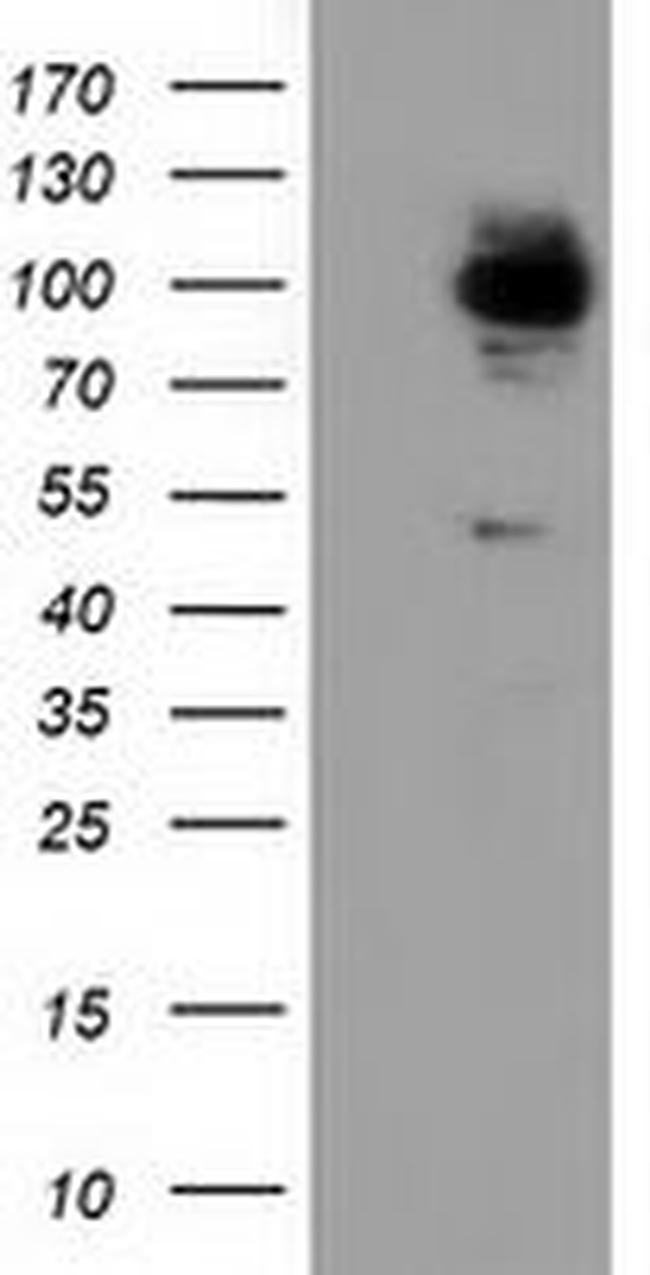 ALDH1L1 Antibody in Western Blot (WB)