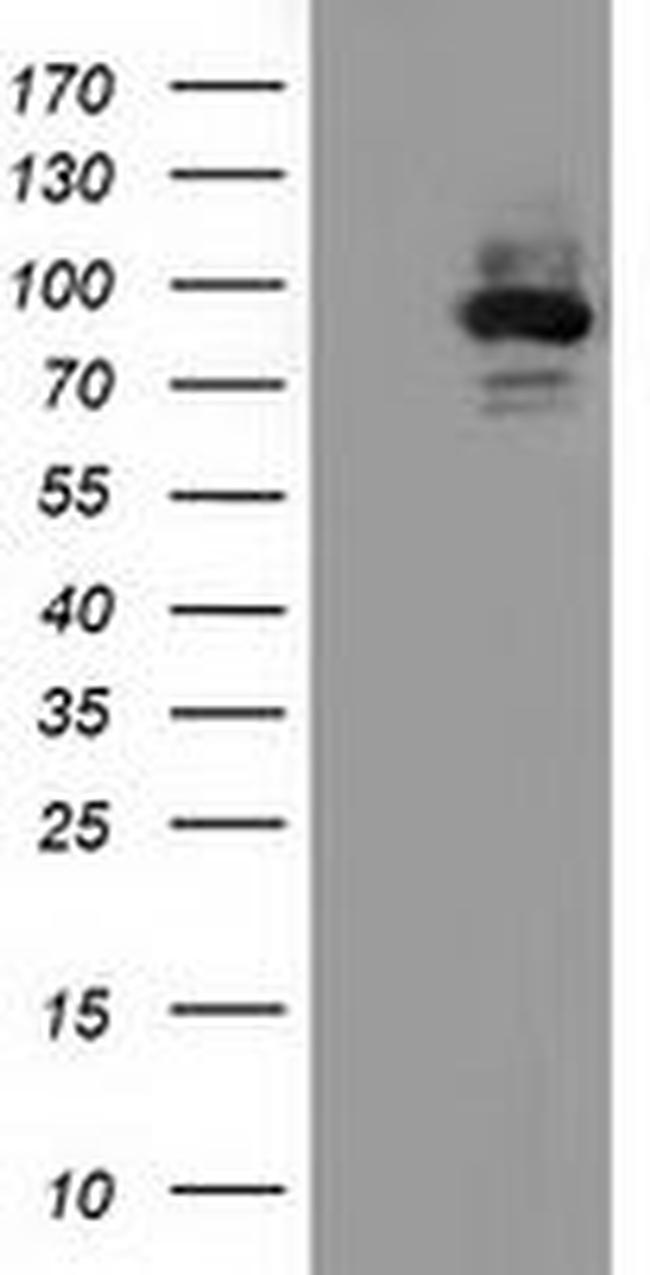 ALDH1L1 Antibody in Western Blot (WB)