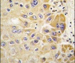 ALDH2 Antibody in Immunohistochemistry (IHC)