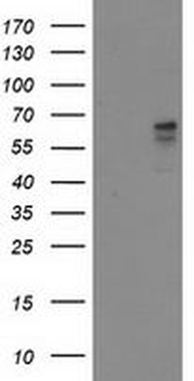 ALDH3A2 Antibody in Western Blot (WB)