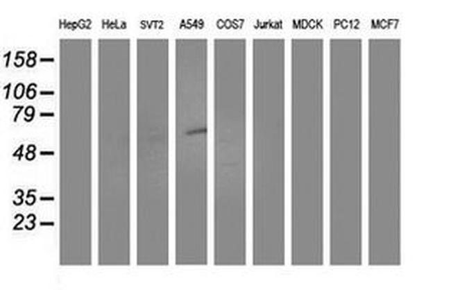 ALDH3A2 Antibody in Western Blot (WB)