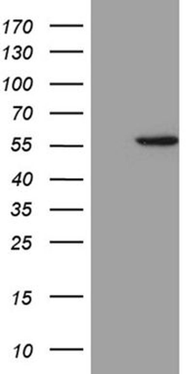 ALDH3B1 Antibody in Western Blot (WB)