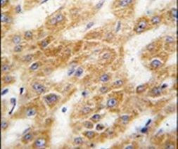 ALDH4A1 Antibody in Immunohistochemistry (IHC)