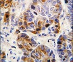 ALDH4A1 Antibody in Immunohistochemistry (IHC)