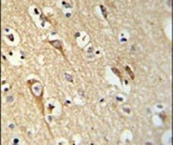ALG10 Antibody in Immunohistochemistry (IHC)