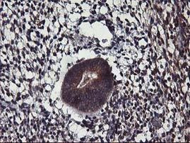 ALG2 Antibody in Immunohistochemistry (Paraffin) (IHC (P))