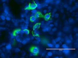 ALK Antibody in Immunocytochemistry (ICC/IF)
