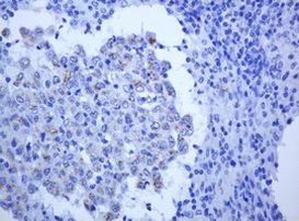 ALK Antibody in Immunohistochemistry (Paraffin) (IHC (P))
