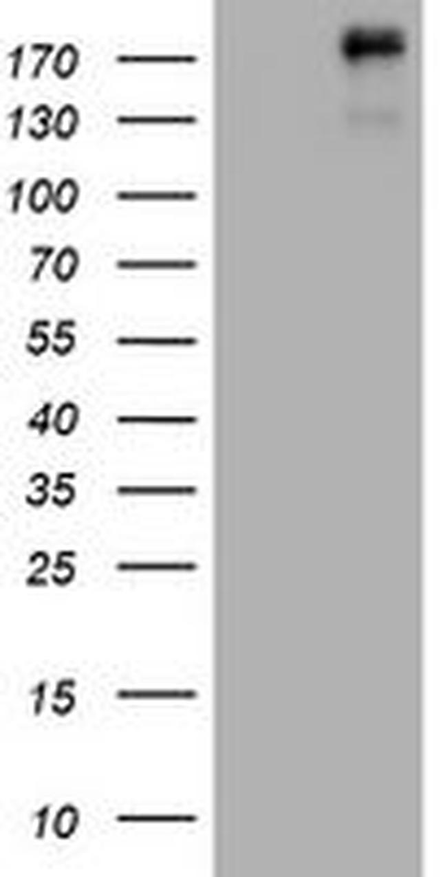 ALK Antibody in Western Blot (WB)