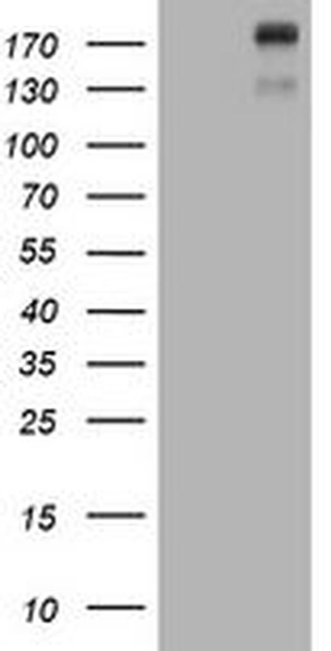 ALK Antibody in Western Blot (WB)