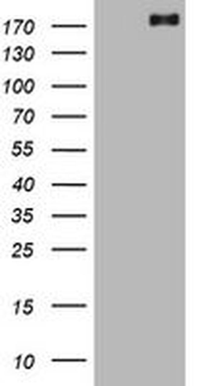 ALK Antibody in Western Blot (WB)