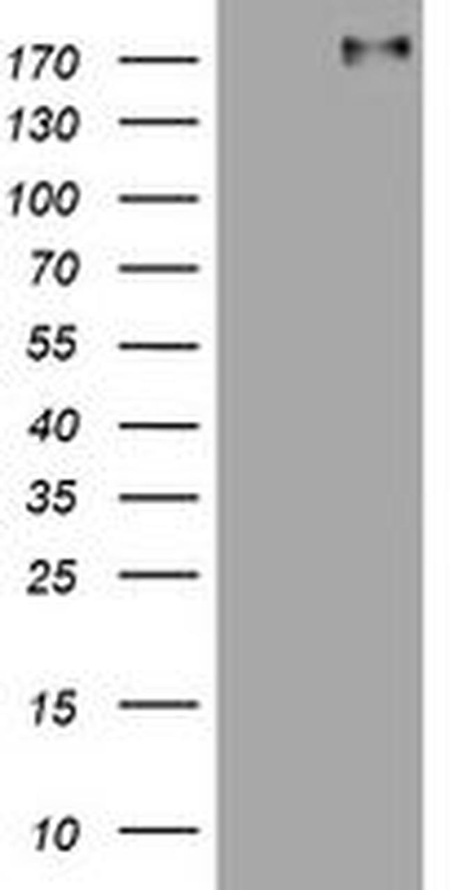 ALK Antibody in Western Blot (WB)