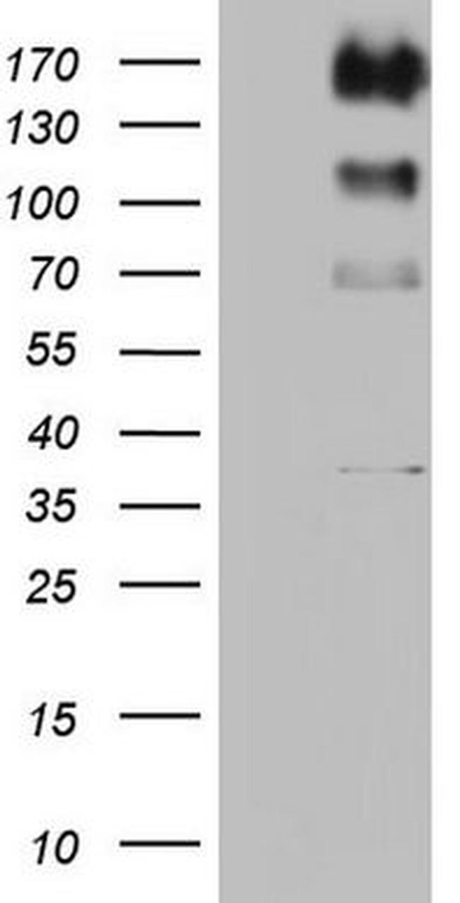 ALK Antibody in Western Blot (WB)