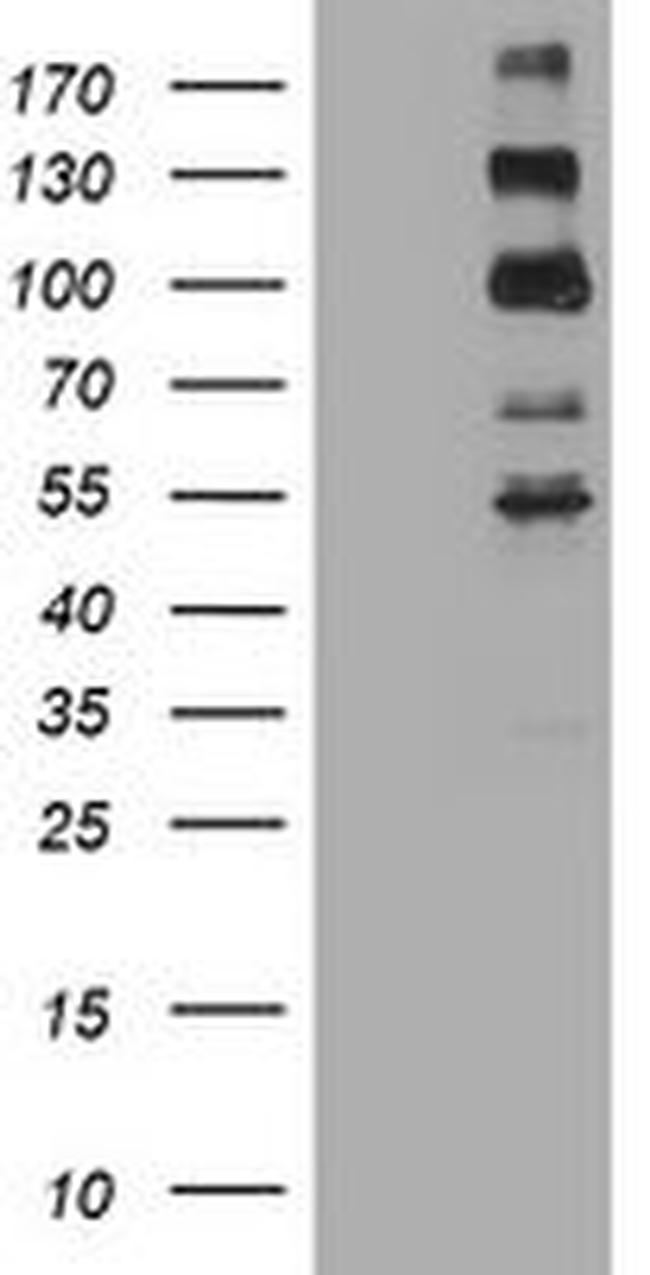 ALK Antibody in Western Blot (WB)