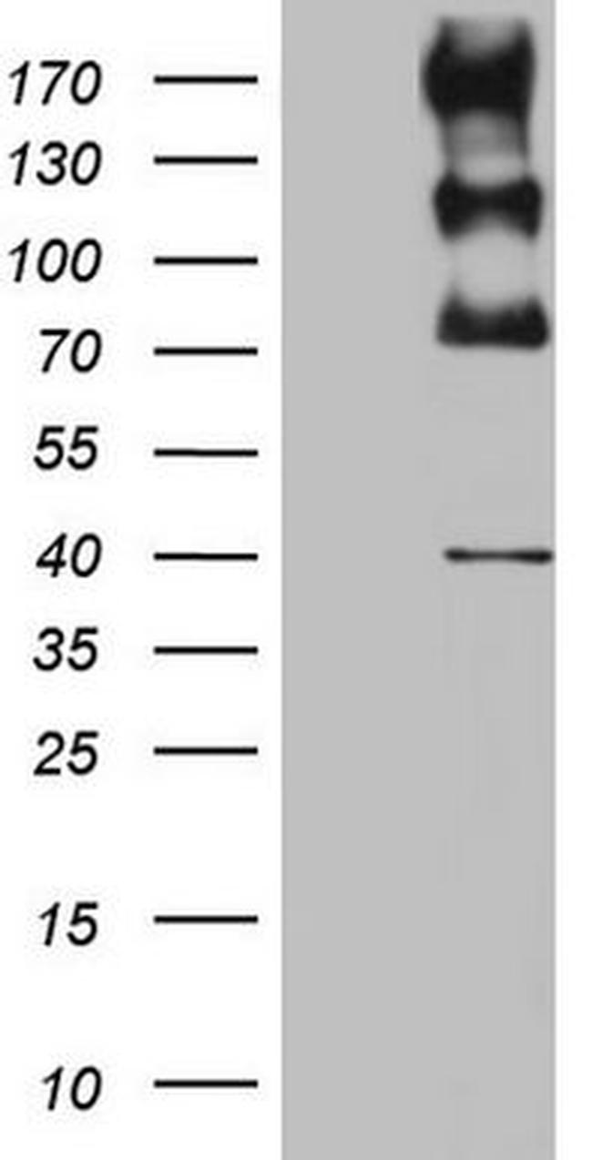 ALK Antibody in Western Blot (WB)