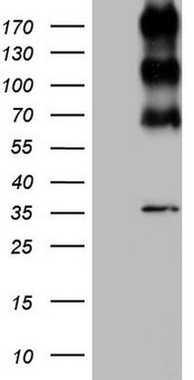 ALK Antibody in Western Blot (WB)