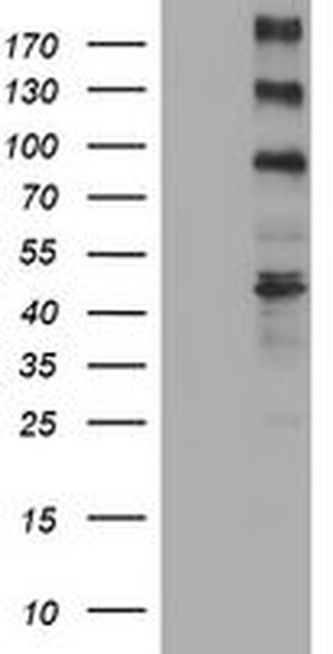ALK Antibody in Western Blot (WB)