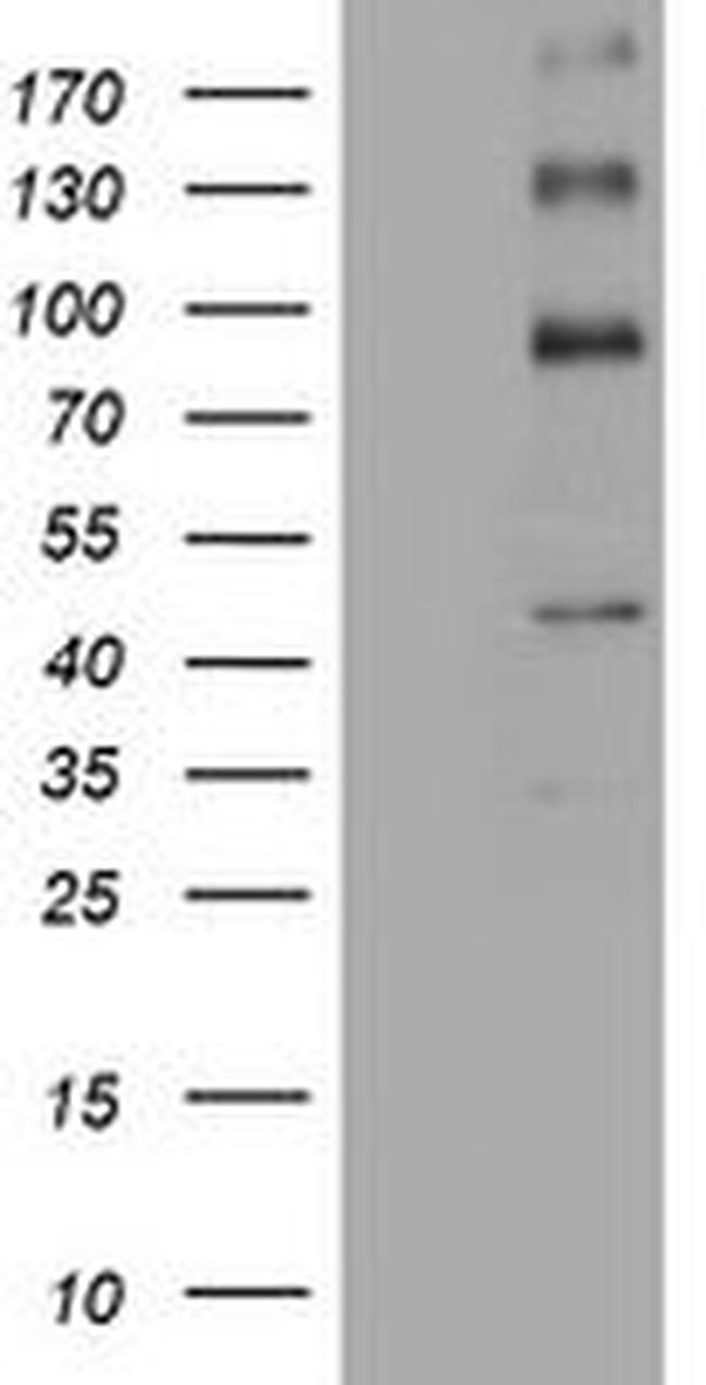 ALK Antibody in Western Blot (WB)