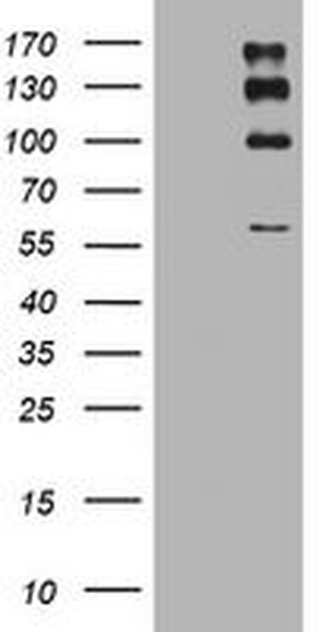 ALK Antibody in Western Blot (WB)