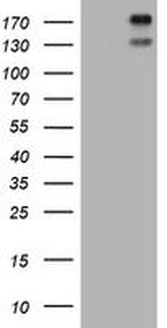 ALK Antibody in Western Blot (WB)