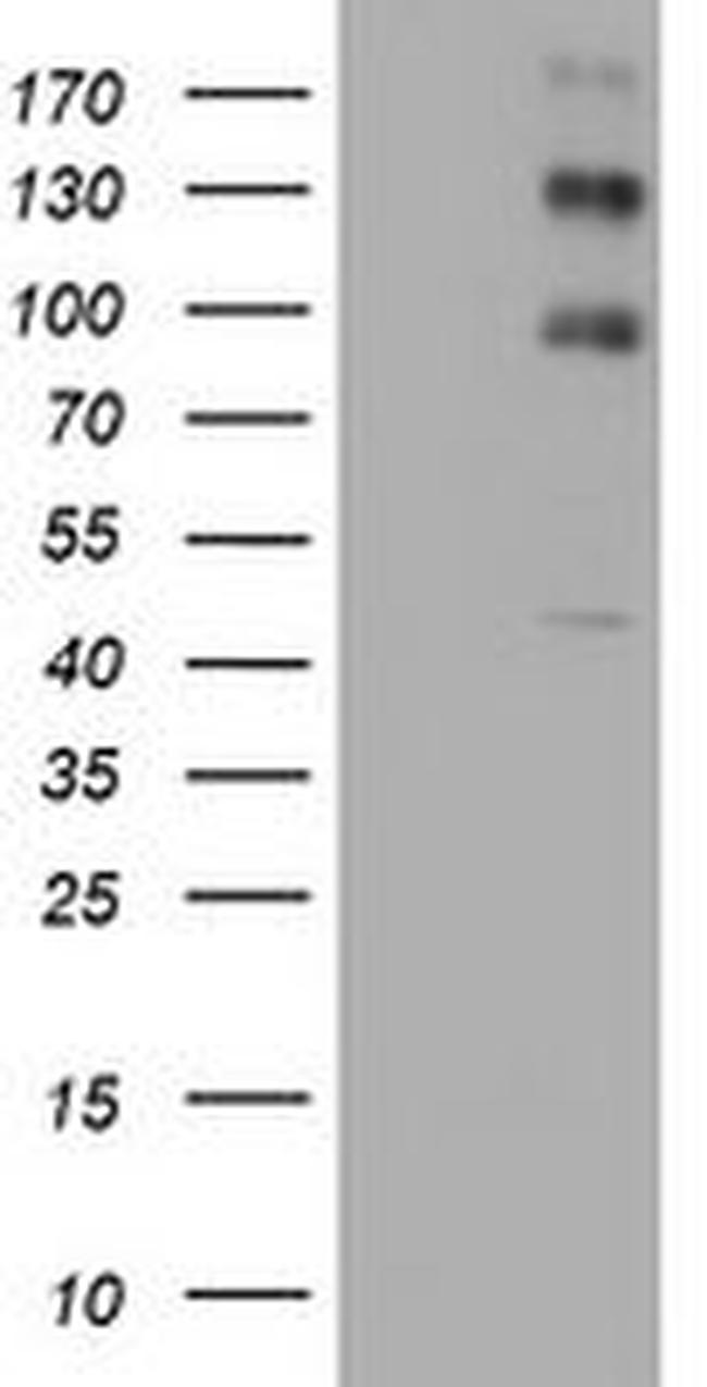 ALK Antibody in Western Blot (WB)