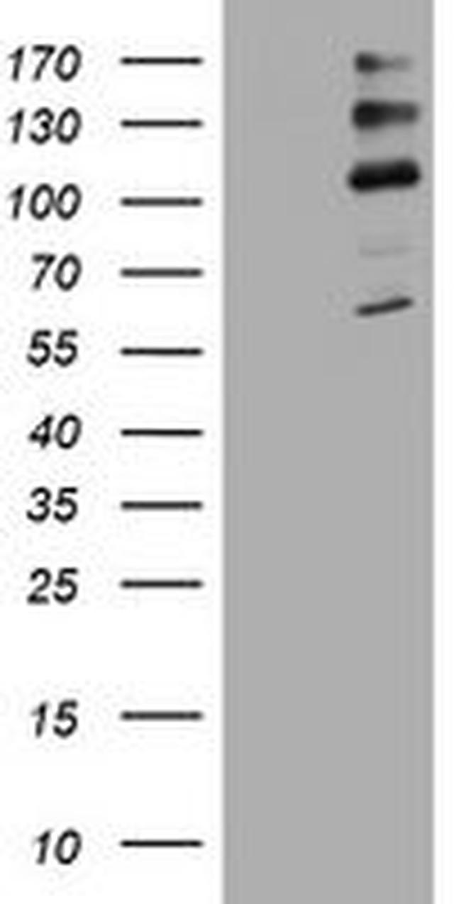 ALK Antibody in Western Blot (WB)