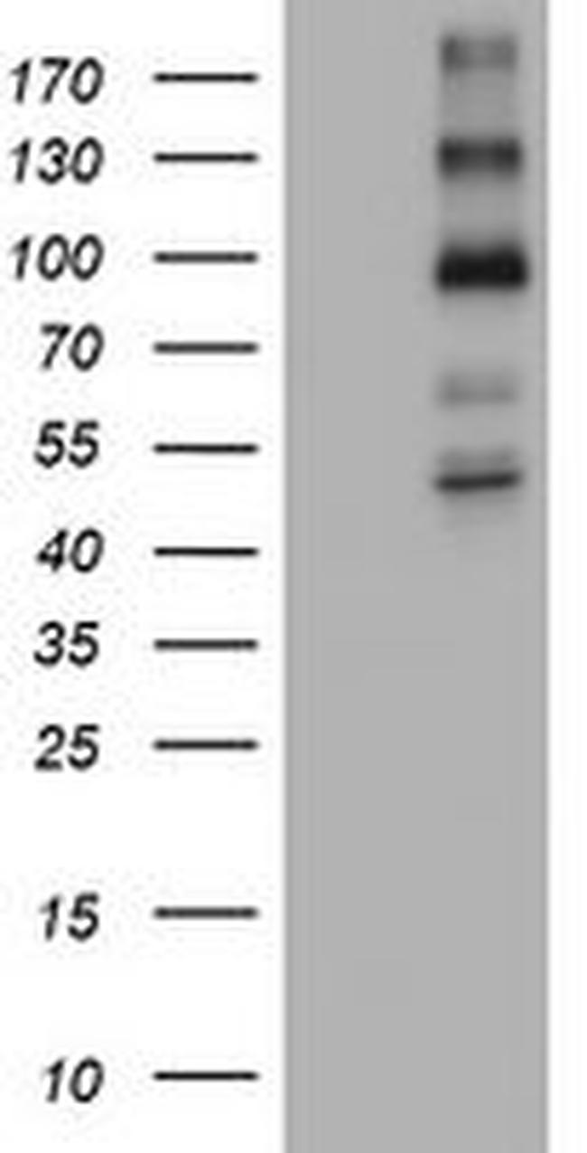 ALK Antibody in Western Blot (WB)