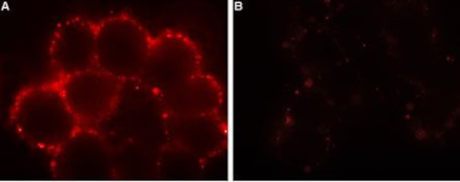 Orai1 (extracellular) Antibody in Immunocytochemistry (ICC/IF)