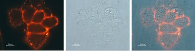 GIRK1 (Kir3.1) (extracellular) Antibody in Immunocytochemistry (ICC/IF)