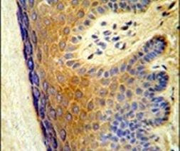 ALOX15B Antibody in Immunohistochemistry (IHC)