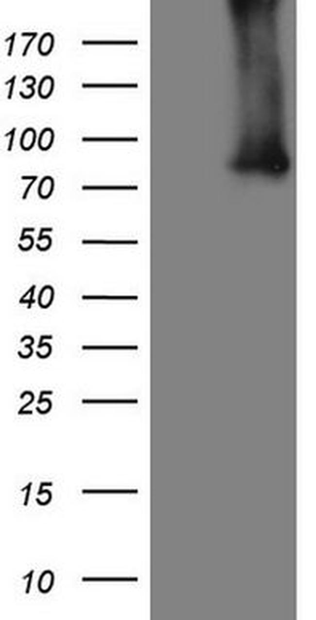 ALOX5 Antibody in Western Blot (WB)
