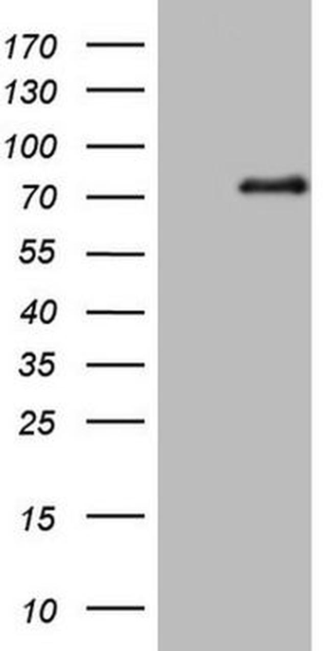 ALOX5 Antibody in Western Blot (WB)