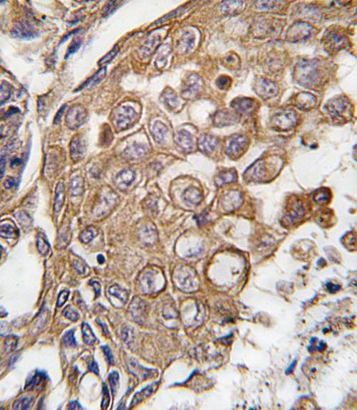 FLAP Antibody in Immunohistochemistry (IHC)