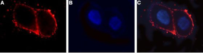 LH Receptor (LHCGR) (extracellular) Antibody in Immunocytochemistry (ICC/IF)