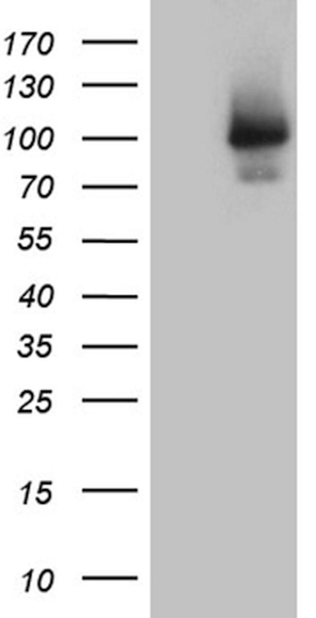 ALS2CR11 Antibody in Western Blot (WB)