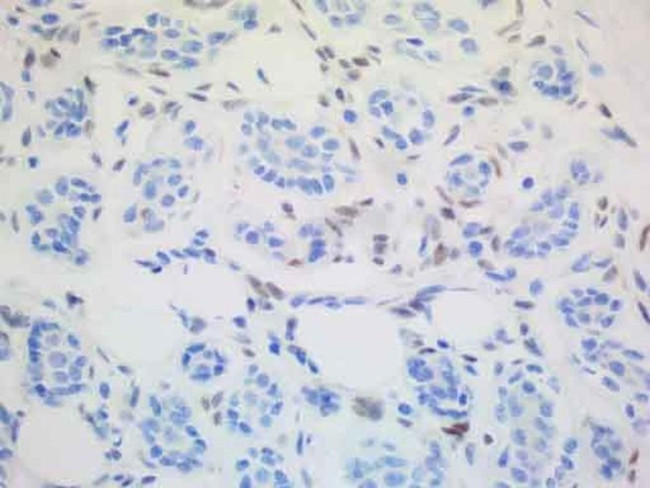 ALX4 Antibody in Immunohistochemistry (Paraffin) (IHC (P))