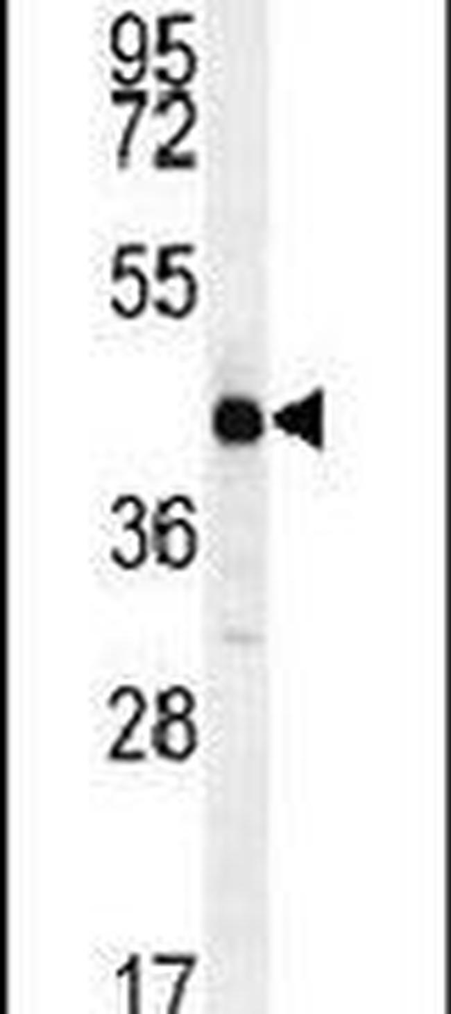 ALX4 Antibody in Western Blot (WB)