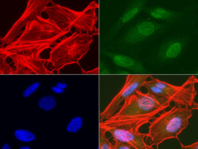 AMACR Antibody in Immunocytochemistry (ICC/IF)
