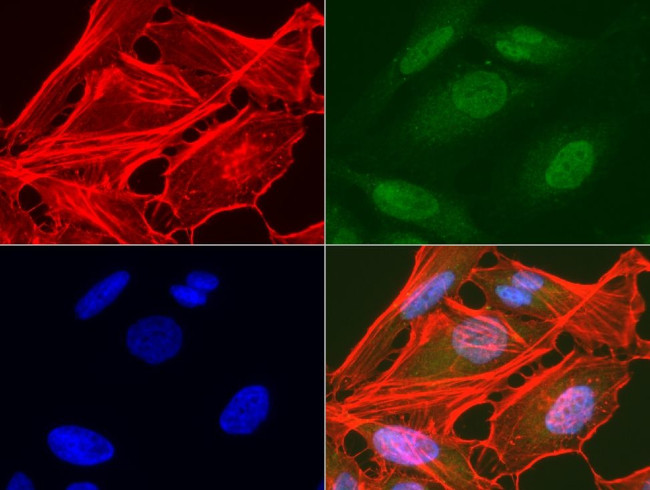 AMACR Antibody in Immunocytochemistry (ICC/IF)